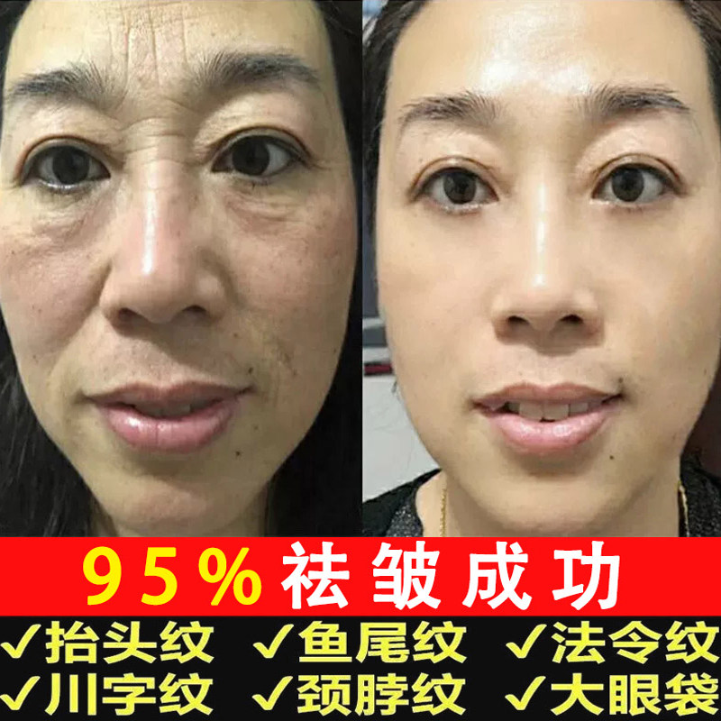 Six-win peptide anti-wrinkle face cream with compact anti-wrinkle aging light crewy and liquid female skin care taster