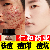 Bright Skin Acne Removing Cream To Pimple Pimple Pit Repair Recessed hole Soybean Care Lotion control Oil Mens special rear back face