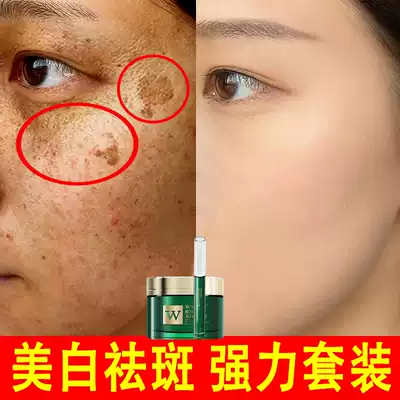 Freckle cream official website flagship store chloasma freckles whitening spots brightening skin color men's special class to buy