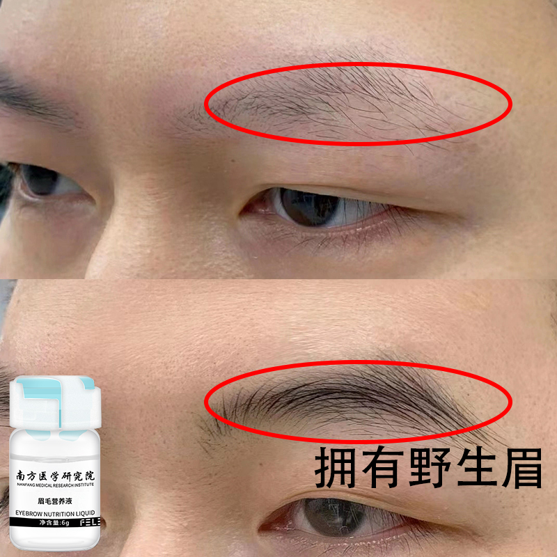 Xiaohongshu recommends brow nutrient solution to bid farewell to eyebrowless nemesis men with wild eyebrows buy two get one free