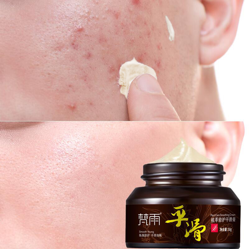 Acne removing pimples to pimple pimples Pimple Pimple Potholes Scars of Concave Holes Comeback Theyre not Aloe Vera Gel Product Women Men