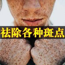 Renhe freckle cream freckle artifact for mens special spot whitening freckle freckle chloasma skin care products