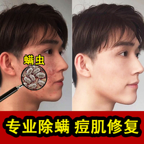 Facial cleanser to remove mites facial pores Facial Oil moisturizing moisturizing artifact skin care products male special to buy