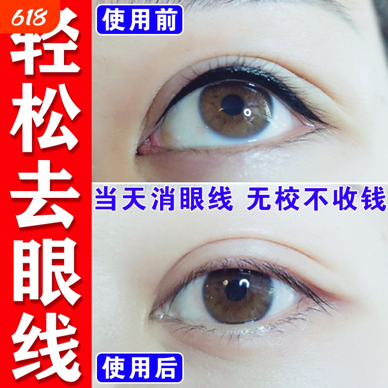Eyeliner Fading Agent for Washing Red Eyebrows, Blue Eyebrow Tattoos, Eyebrow Tattooing, Semi-Permanent Eyeliner, and Quick Fading of Beauty Eyeliner Lines - a Special Tool Eyeliner Fading Agent for Washing Red Eyebrows, Blue Eyebrow Tattoos, Eyebrow Tattooing, Semi-Permanent Eyeliner, and Quick Fading of Beauty Eyeliner Lines - a Special Tool