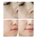 米云 Тонер на основе аминокислот, глубокое очищение, контроль жирного блеска