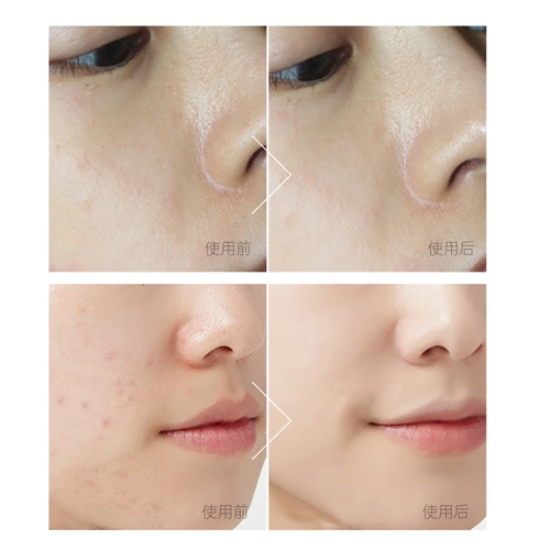 米云 Тонер на основе аминокислот, глубокое очищение, контроль жирного блеска