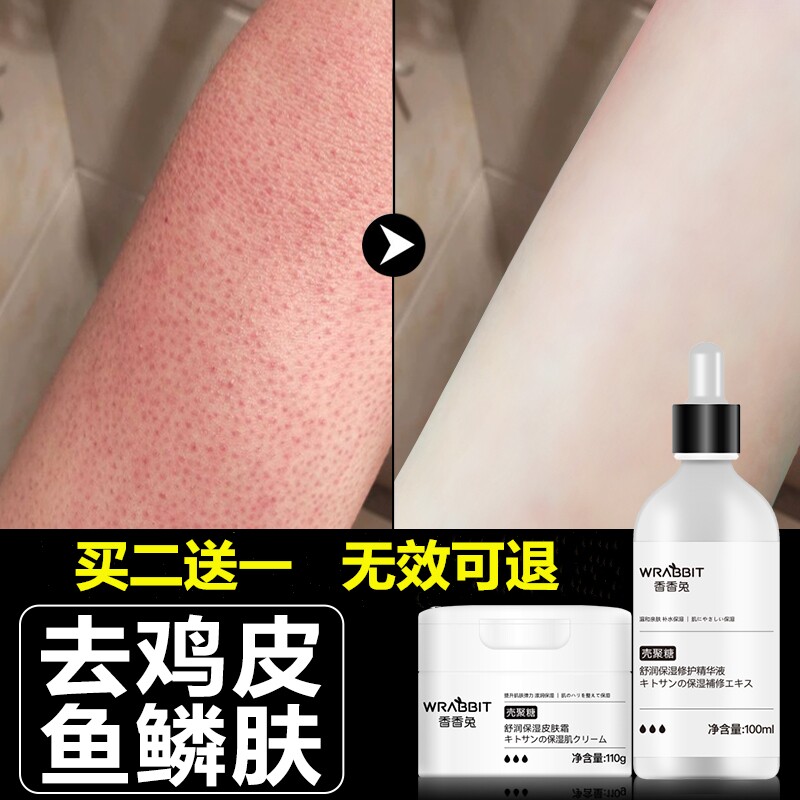 Japanese chicken skin pimple hair follicle keratinized fruit acid body milk hydrating moisturizing nicotinamide ichthyosis skin cream