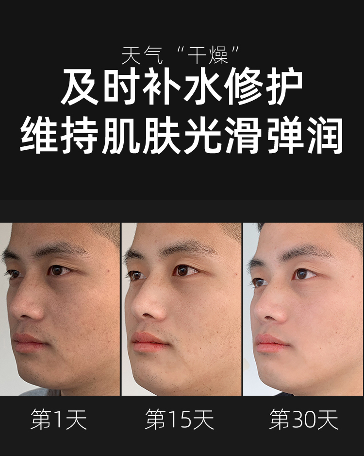韩国进口 AHC 男士水乳套装 三件套 图7