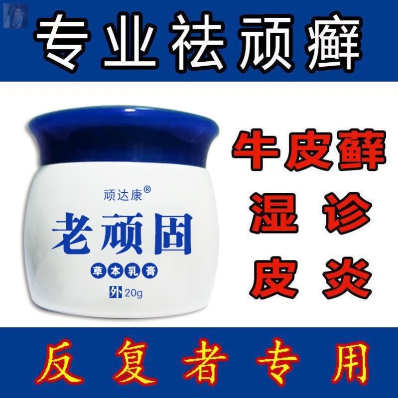 Buy 2 send 1 3 send 2 Naughty old stubborn herbage Bacteriostatic Milk Cream Old Partial Skin Itching Ointment Itching
