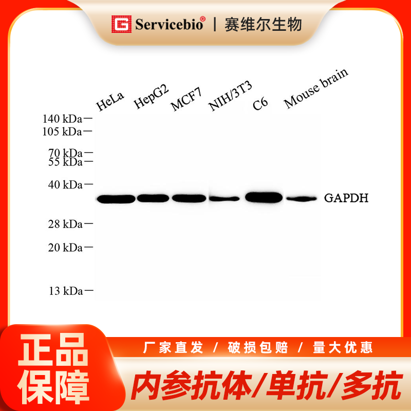 赛维尔抗体 一抗/二抗/内参抗体