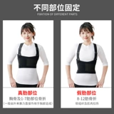 Медицинские грудные ребра перелома с фиксированной зоной после выздоровления