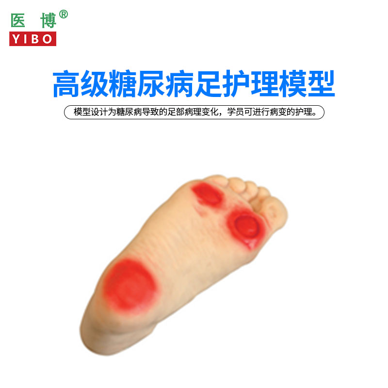 医博BIX-HS19 糖尿病足护理模型 足部病理展示示教模型教具