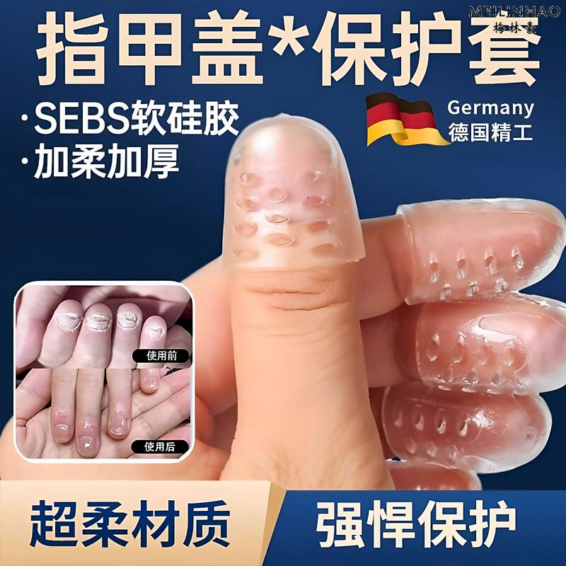 German Finger Protectors for Broken Nail Caps, Waterproof Protective Nail Covers for Separation and Protection Yw