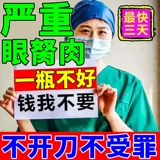 Устранение глаза глаз, глазные капли, глаза, глаза, полипы мяса, инородное тело, глаз, сухой зуд, усталость, зелье усталости