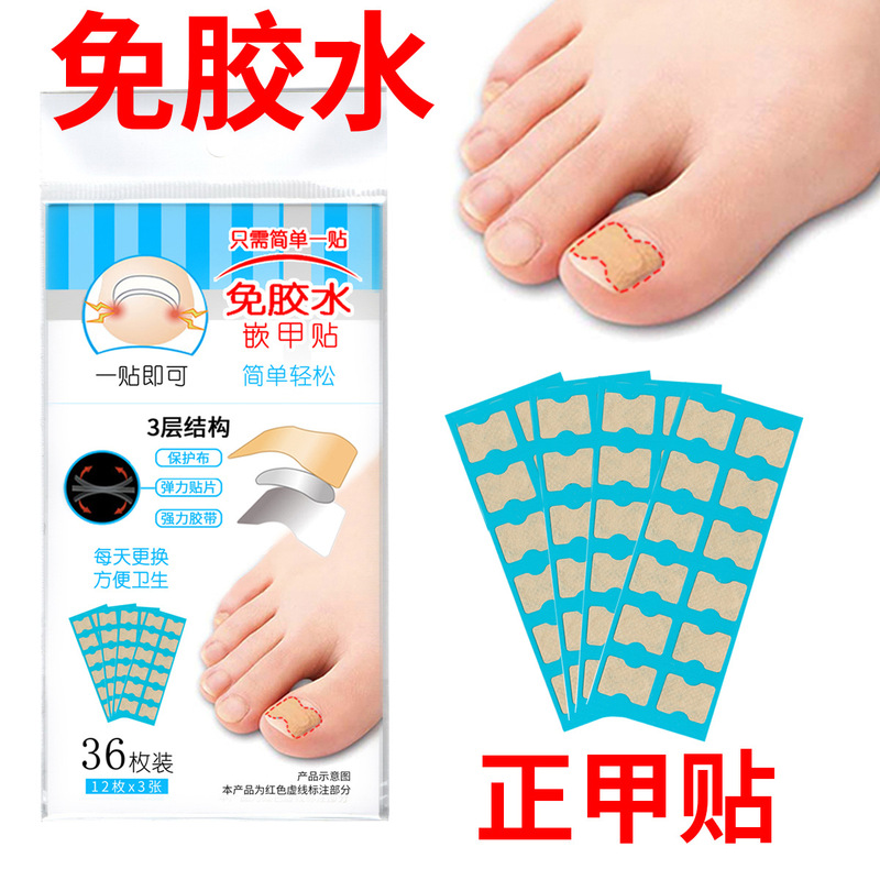 Ingrown Toenail Correction Patch, Toenail Groove Correction Device, Ingrown Toenail Nemesis Treatment Tool