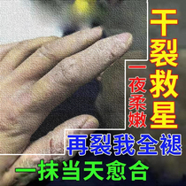 Hand itching small blisters hand Qi anti-itching cream water bubble type itching peeling seasonal cement allergy antipruritic skin