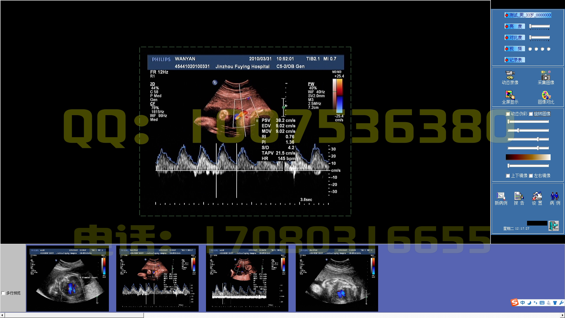 Ultrasound as you want