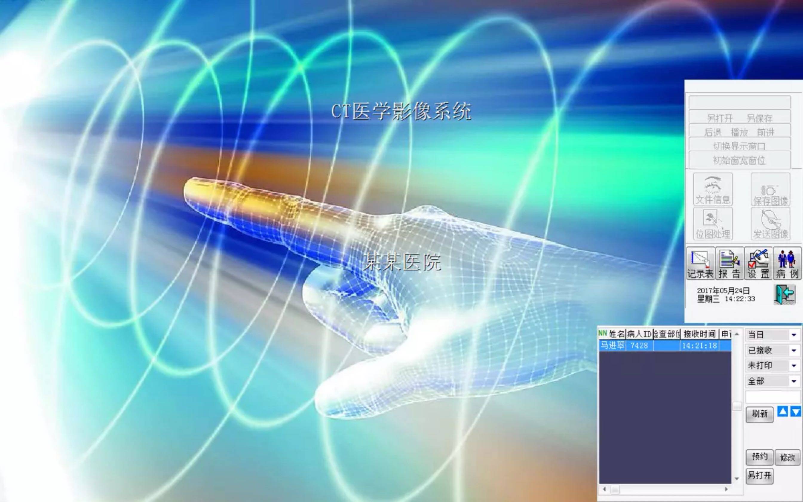 CT workstation software CT graphic report software DR workstation software CR workstation software NMR software