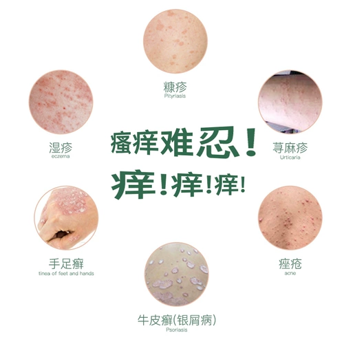 优禾康 Холодный компресс, кожаный гель от экземы, мазь, против зуда