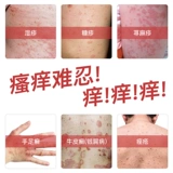 优禾康 Холодный компресс, кожаный гель от экземы, мазь, против зуда