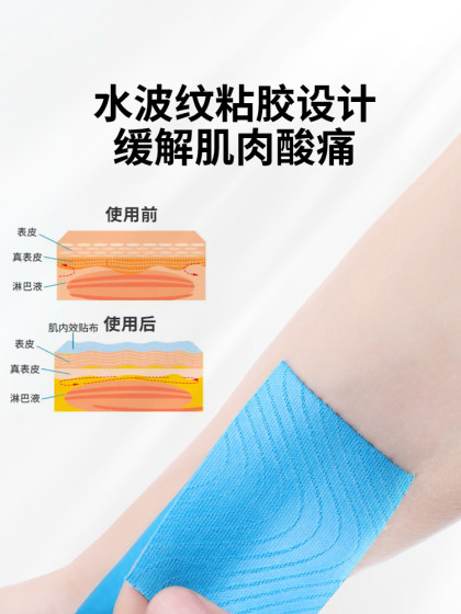 肌肉贴运动员专用肌贴运动绷带拉伤肌内效贴篮球羽毛球肌效贴自粘