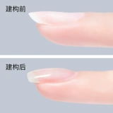 Японская консервированная форма, построение арматуры нижнего клея, одна светотерапия, гвозди герметизации.