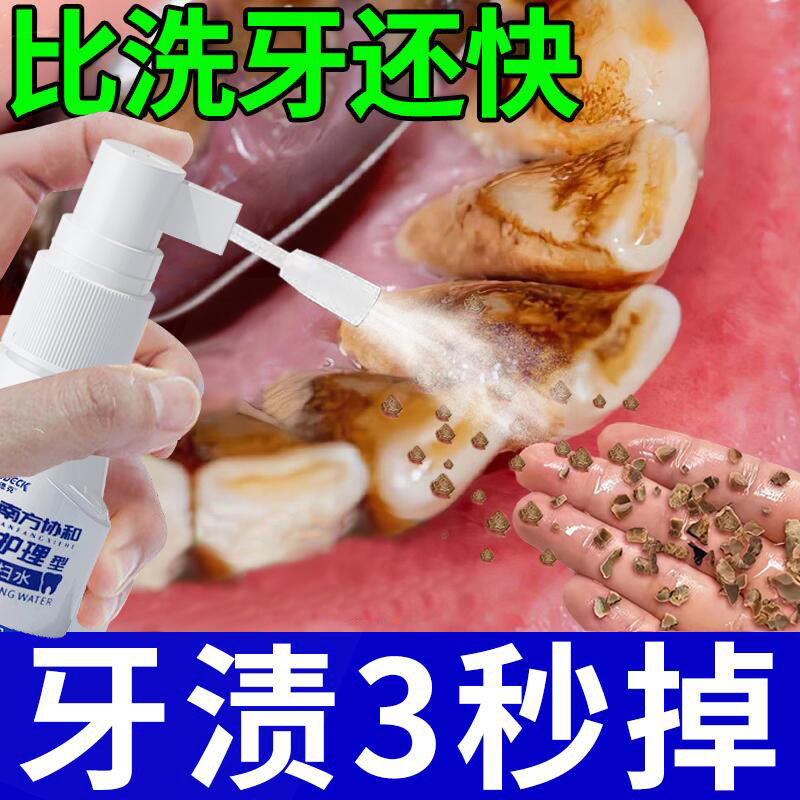 (Teeth White more beautiful) Teeth to Yellow Stones Smoke Stains Tea Stains for men and women Universal Dentin Yellow Theorizer Buy 2 delivery 1-Taobao