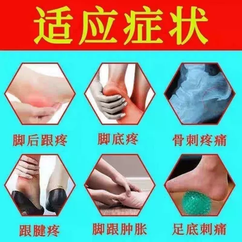 Обобальная фасция каблубная фасция гиперплазия Специальная мазь кости шпоры Удаляйте корни ахиллесо