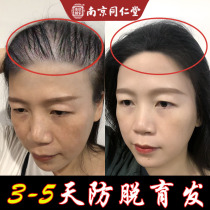 Tongrentang anti-hair loss hair growth liquid Hair growth density development hairline hair rapid growth hair agent essence artifact