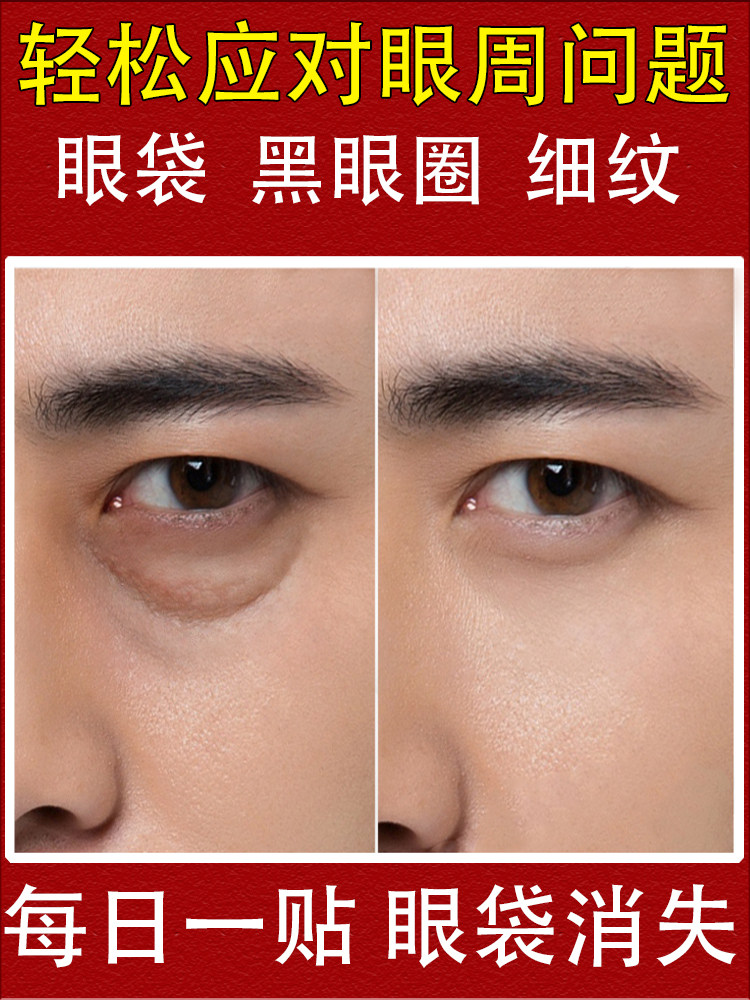 Renhe snake venom eye mask official flagship store eye bag stickers men's artifact dilutes dark circles and fine lines for men to buy