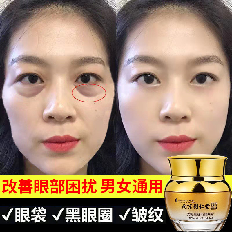 Nanjing Tongrentang Eye cream goes to fine tattoo with tight black eye ring to eye bag Tears official flagship store
