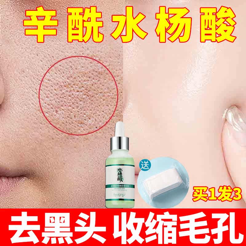 Salicylic acid and cynyl salicylic acid with preparation to black head closed mouth low concentration pores coarse shrinkage fine hua liquid female