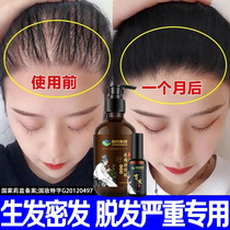 Anti-hair shampoo Fleece Fleece Fleece Fleece Ginger hair growth Yukon juice to dandruff anti-itchy oil fluffy lady