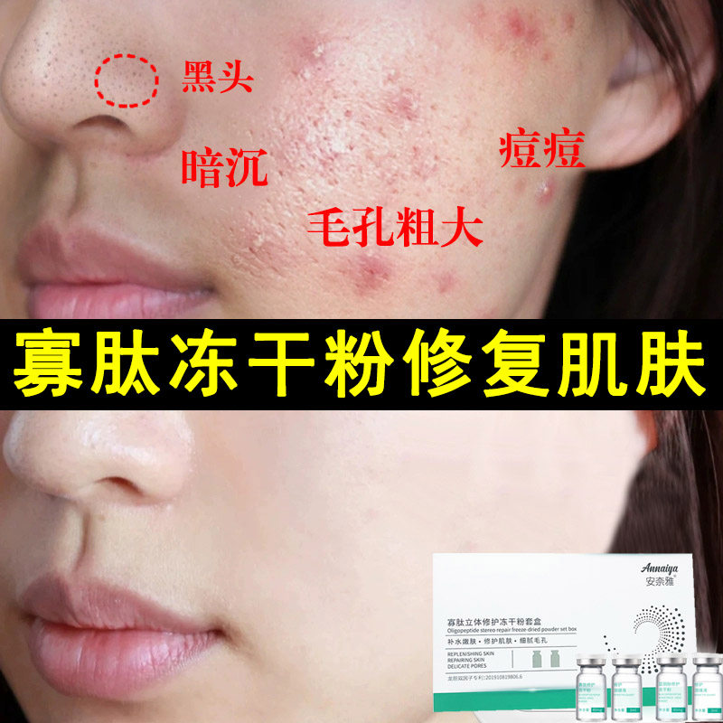 Polypeptide freeze-dried powder dispel imprint to repair red blood silk skin-care products beauty salon special cover box flagship store official