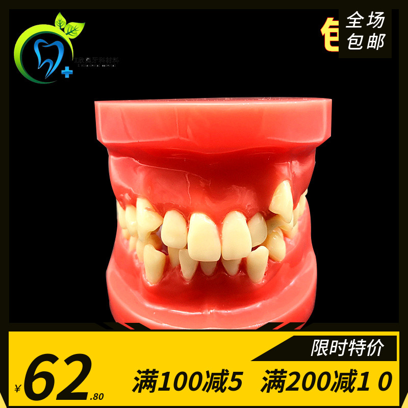 牙科口腔模型 正畸模型 正畸错颌展示模型 口腔教学展示模型 齿科