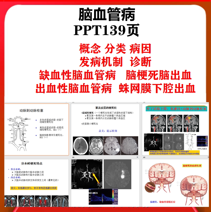 Ischemic Cerebrovascular Disease, Cerebral Infarction, Hemorrhagic Cerebrovascular Disease, Subarachnoid Ppt Courseware Diagnosis Ischemic Cerebrovascular Disease, Cerebral Infarction, Hemorrhagic Cerebrovascular Disease, Subarachnoid Ppt Courseware Diagnosis