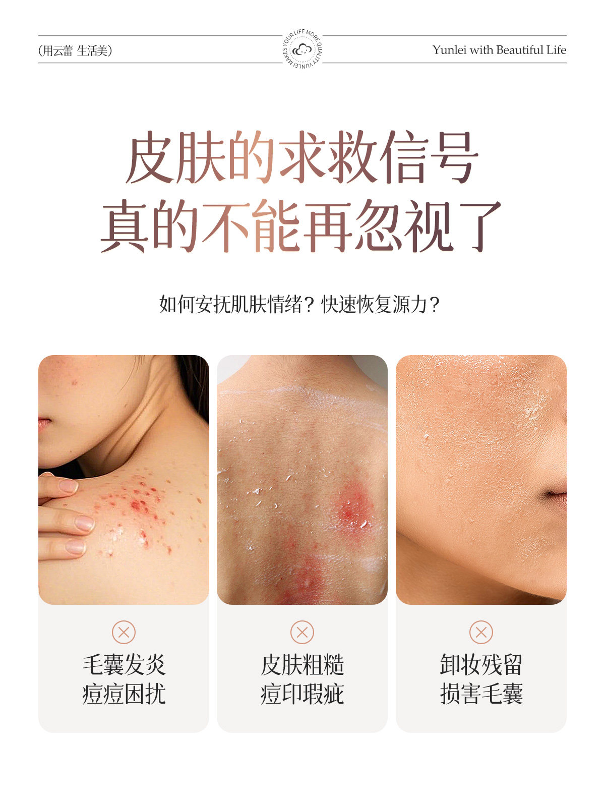 【中國直郵】 雲蕾 卡通二合一雙面澡巾浴花 白色 1件 後背搓泥 洗澡 沐浴球 可掛