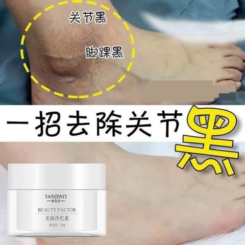 NAR Undermars вниз по черному кустарнику и колене отбеливание колена, мертвая кожа, локоть, пальцы, пальцы, черный трансформирующий белый артефакт