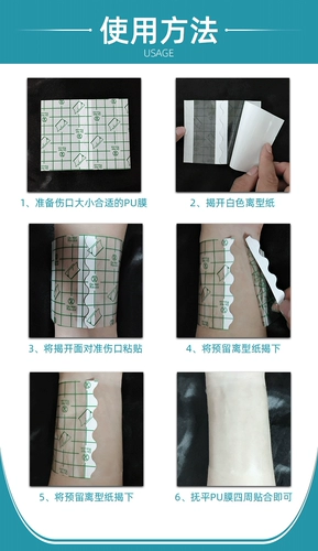 Водонепроницаемая наклейка, полиуретановая лента, послеоперационный прозрачный послеродовой бондаж