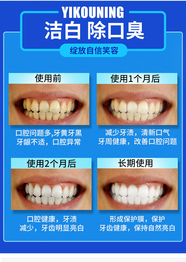 小苏打牙膏新款正品美白去黄亮家庭装成