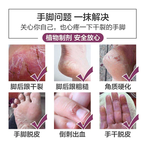 Xiaohongshu Hot -Showerseclosion ~ ног стопы ~ сегодняшняя специальная цена ~ купи один, получи один бесплатный