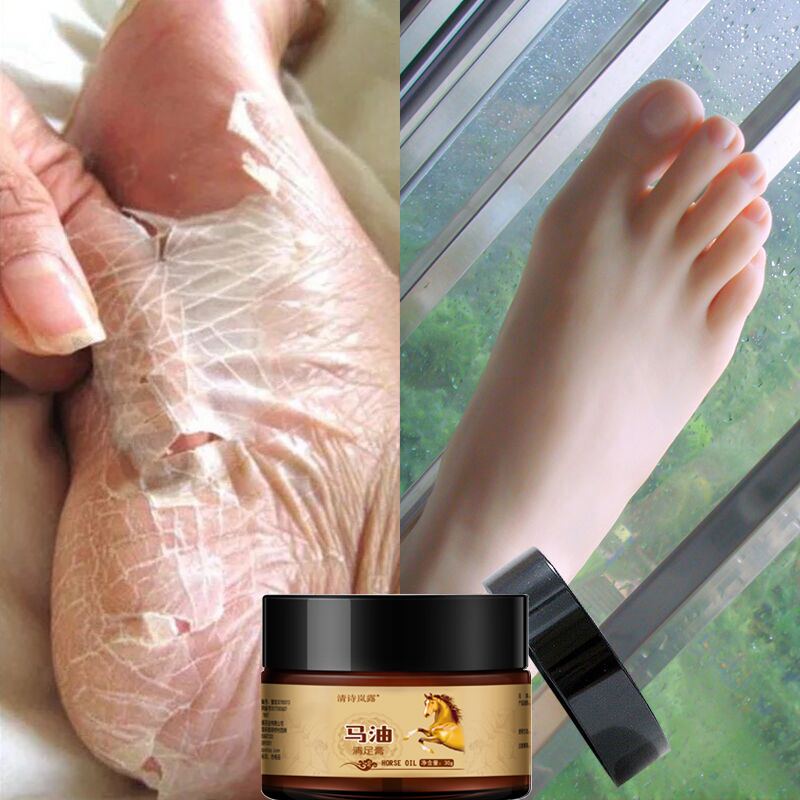 Today's special price ~ footed steak's hands and feet dry and cracked to buy a one-and-a-one.