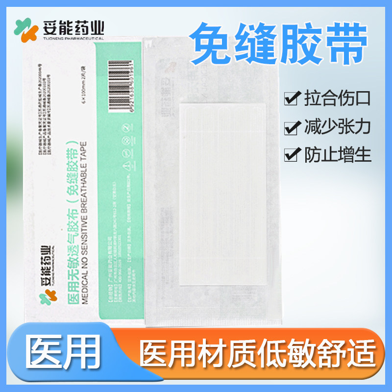 妥能免缝胶带剖腹产伤口术后皮肤拉合美容儿童脸抑制防疤痕减张贴