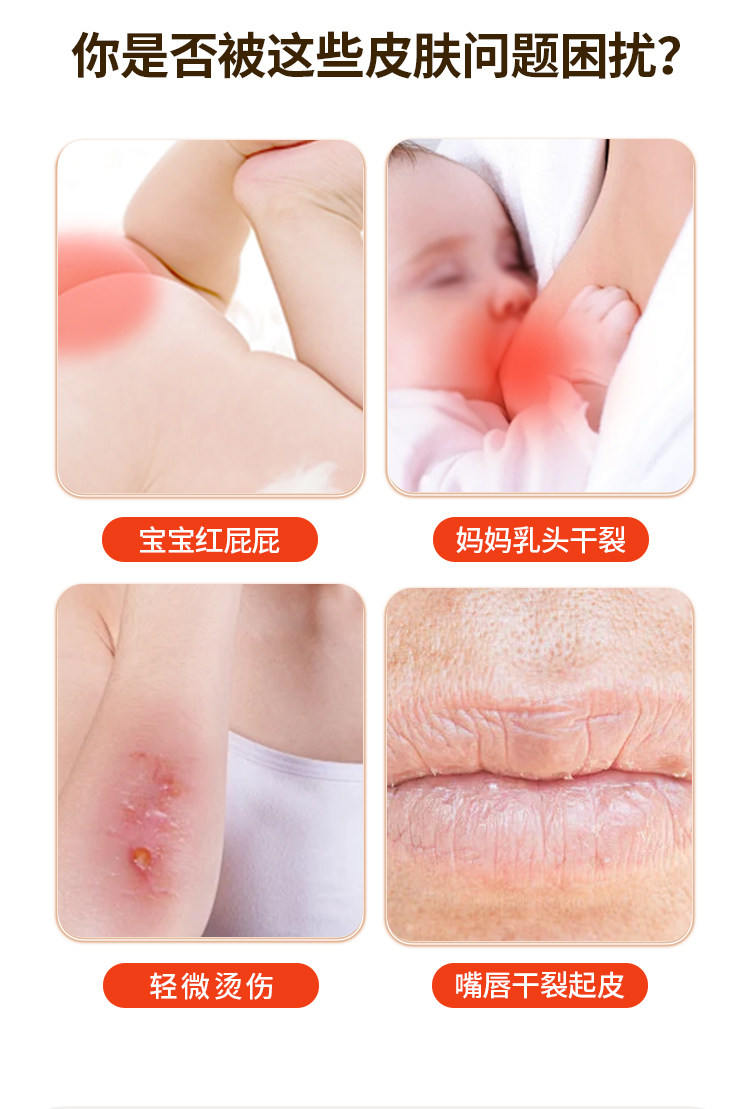 纯正蛋黄油婴儿孕妇专用哺乳期乳头干裂鸡蛋油宝宝红屁股护臀膏 — 3