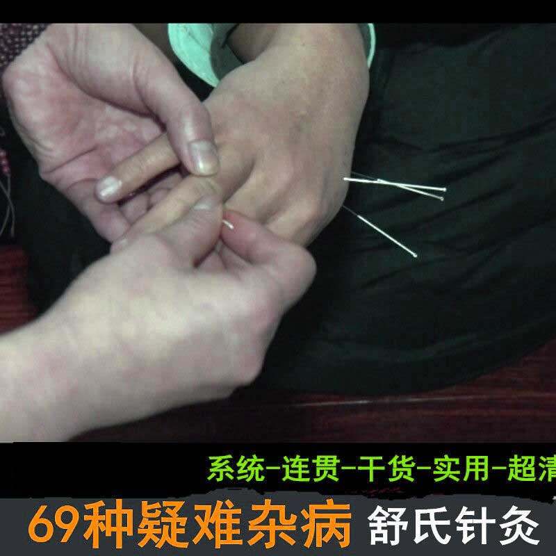 202221 newly sorted out a full set of Shu's acupuncture 69 kinds of difficult and miscellaneous diseases advanced practical class nameplate dry goods case practice system diagnosis of Traditional Chinese medicine teaching methods training acupuncture color ultrasound video