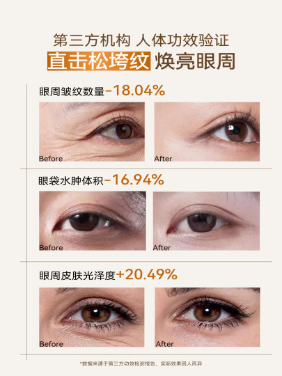 嘉兰杜汀多肽眼霜紧致眼周保湿黑眼圈眼纹韩国原装进口GalanDutin
