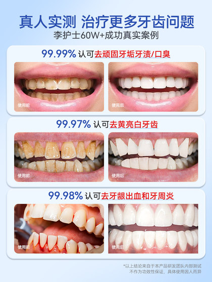 牙龈修复专用非牙膏萎缩治牙周炎口腔护理脱敏再生官方正品旗舰店
