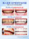 牙龈修复专用非牙膏萎缩治牙周炎口腔护理脱敏再生官方正品旗舰店