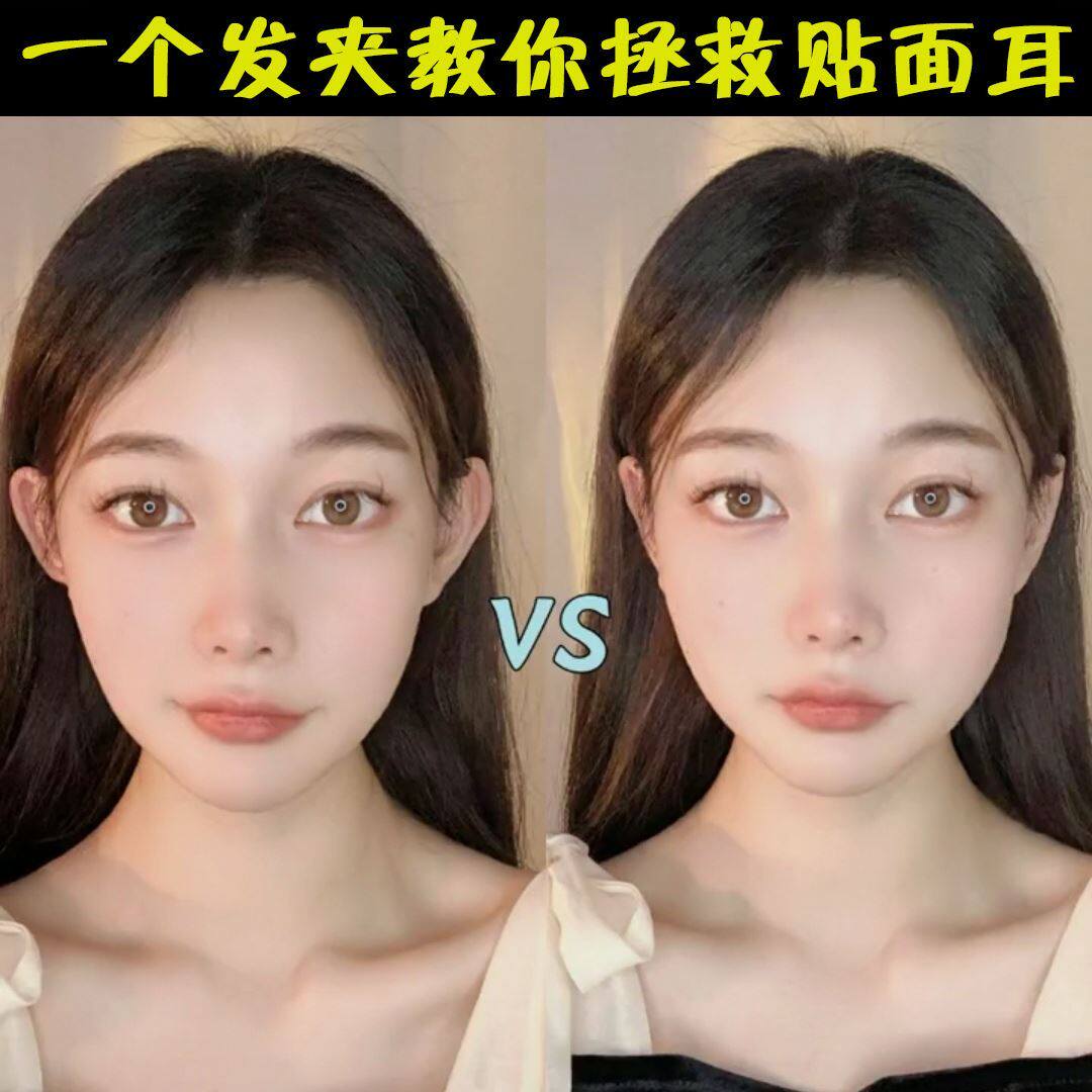 Fixed ears recruit the ear ear ear ear ear clamp ear clamp ear clamp