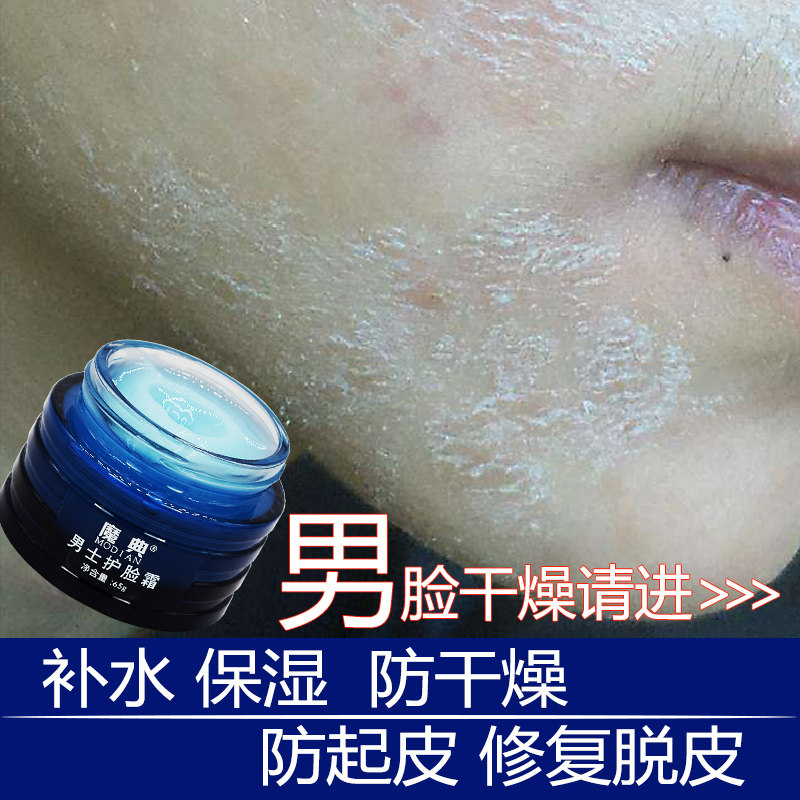 Male face drying up to repair cream fall skin Poppy peeling peeling back and dry skin Facial Skin Care moisturizing moisturizing